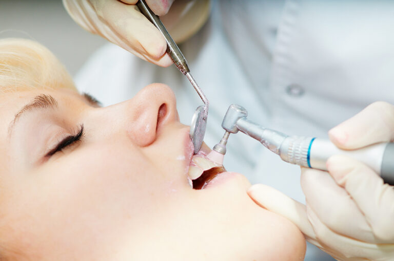 What Is a Prophylaxis? What Does Dental Prophylaxis Involve?
