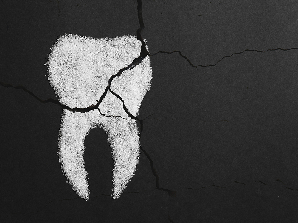 Detecting and Treating a Cracked Tooth